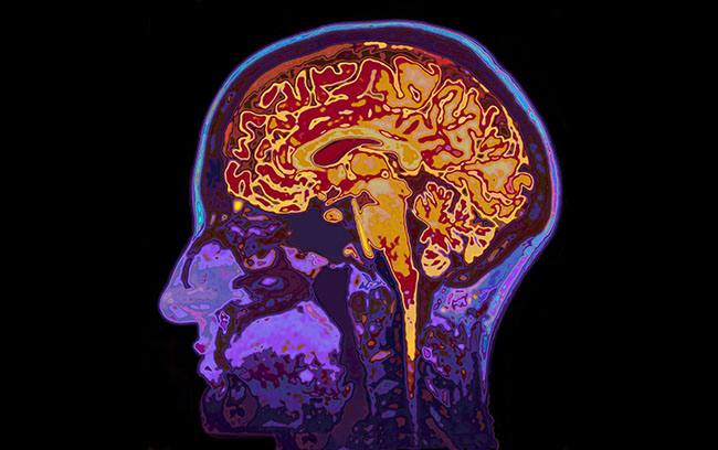 brain scan from a fMRI scanner 